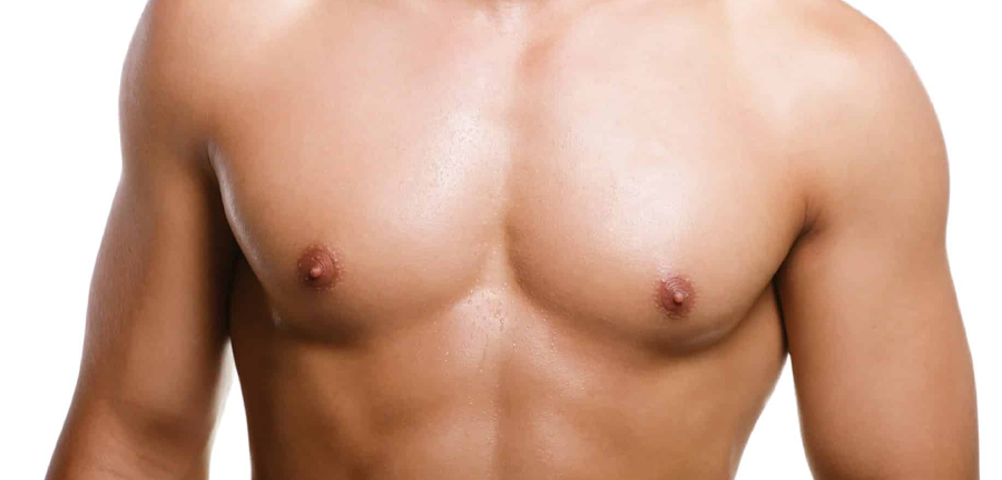 Gynecomasty